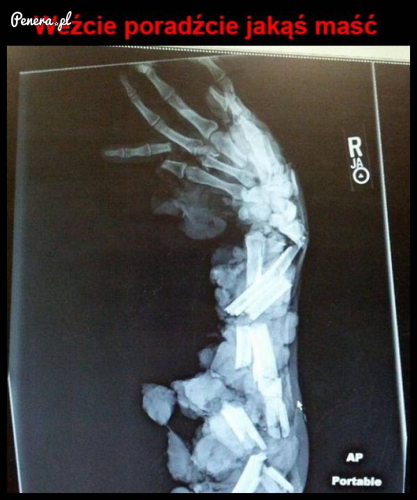 Ktoś poradzi jaka maść najlepsza?