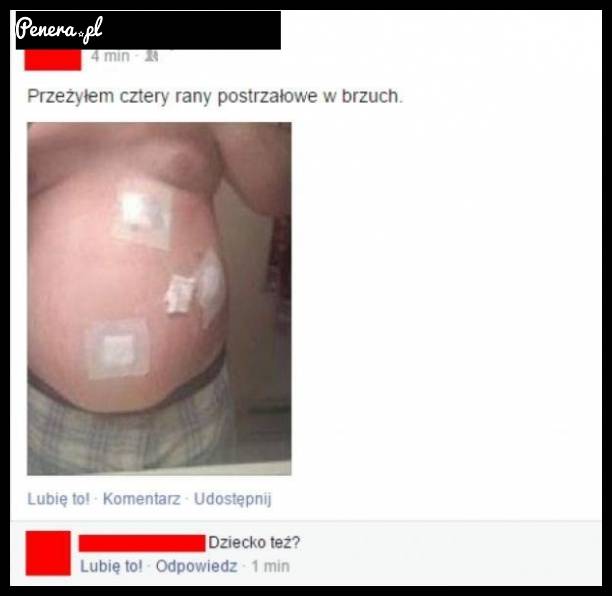 Przeżył rany postrzałowe brzucha