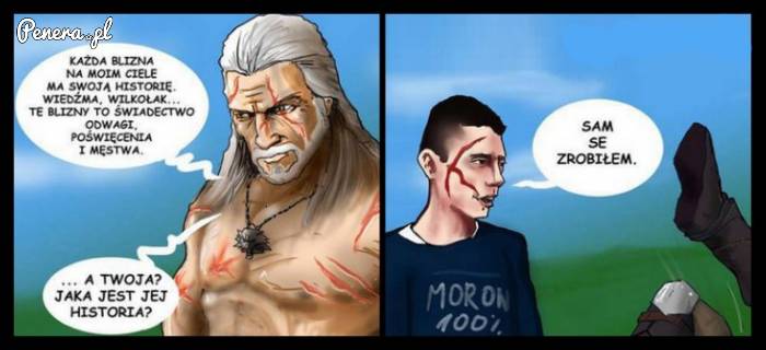 Każda blizna wiąże się z jakąś historią