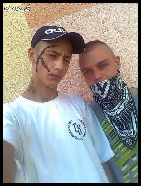 Karol tylko nie drap bo zostaną blizny