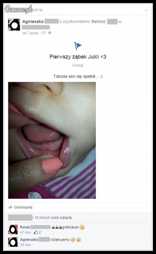 Pierwszy ząbek na fejsie