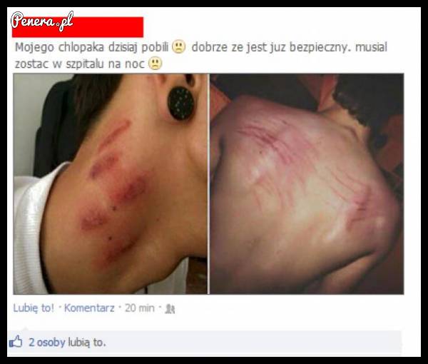 Pobili jej wczoraj chłopaka :D