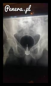 Tymczasem na ostrym dyżurze