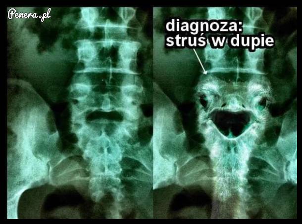 Diagnoza może być tylko jedna