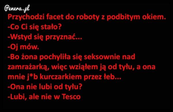 Przychodzi facet do roboty z podbitym okiem