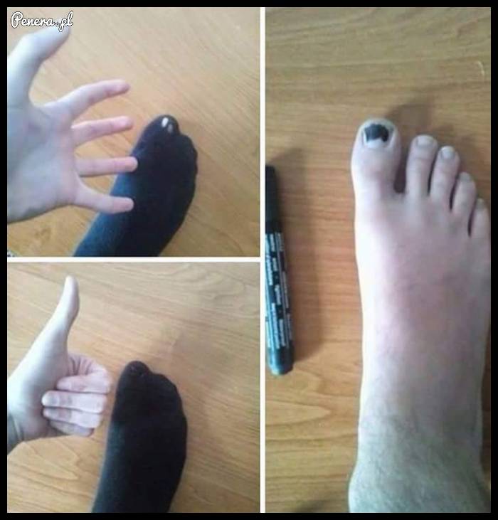 Kiedy masz dziurawą skarpetkę możesz zrobić coś takiego
