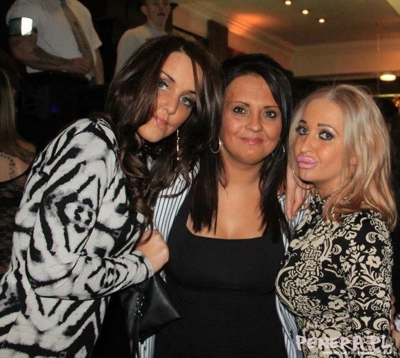 Botox plus Botox równa się ogromne wary obciągary Botox plus Botox równa się ogromne wary obciągary