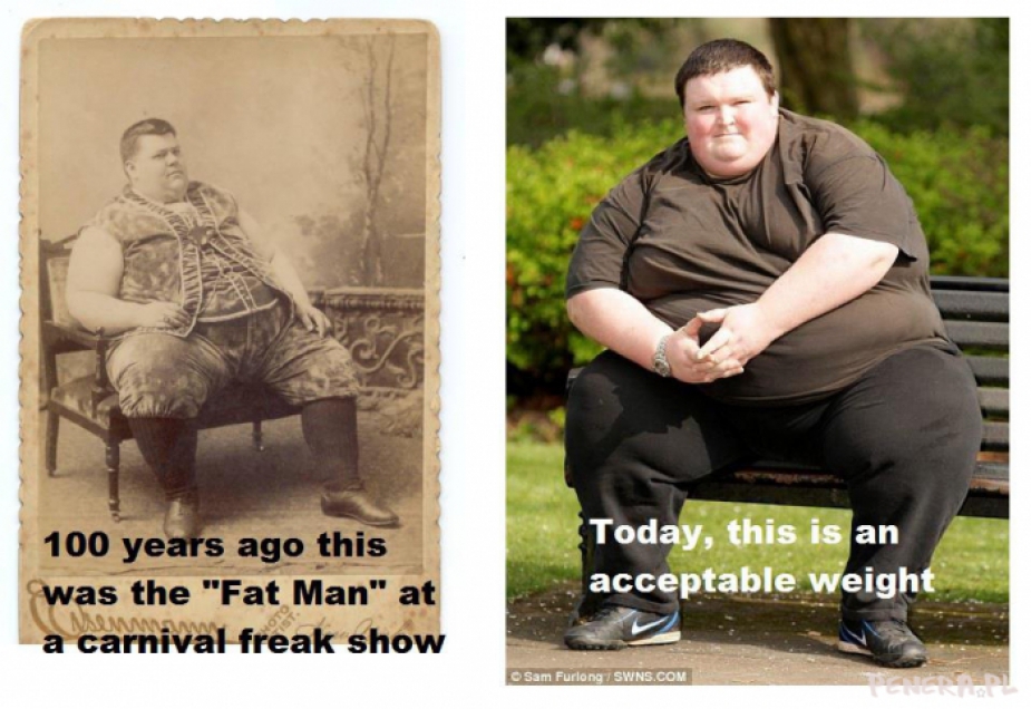 100 lat temu grubas był cyrkowym dziwakiem 100 lat temu grubas był cyrkowym dziwakiem