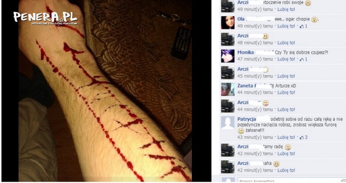 Debilizm pierwszego stopnia Debilizm pierwszego stopnia