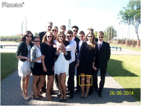 Ciekawe od czego kolana zdarte ;)