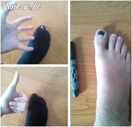 Co zrobić z dziurawą skarpetką