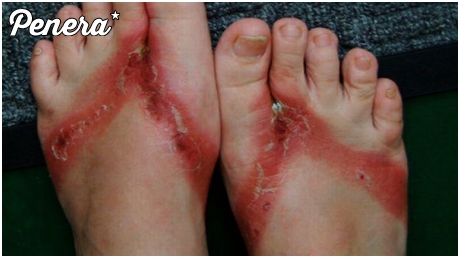 Efekt kupowania chińskich klapków