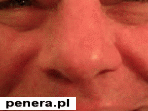 Hurtowe wyciskanie pryszczy na nosie