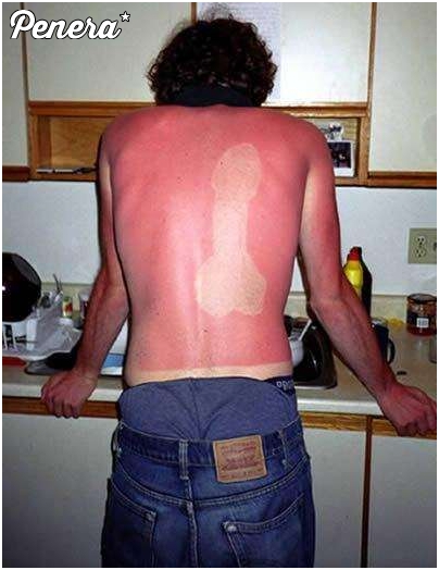 Karny kut*s za spanie na słońcu :D