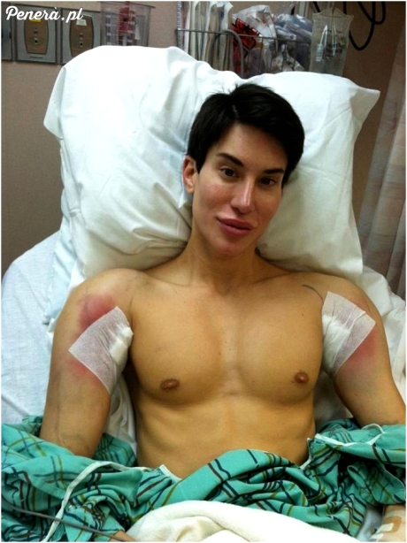 Ken wylądował w szpitalu