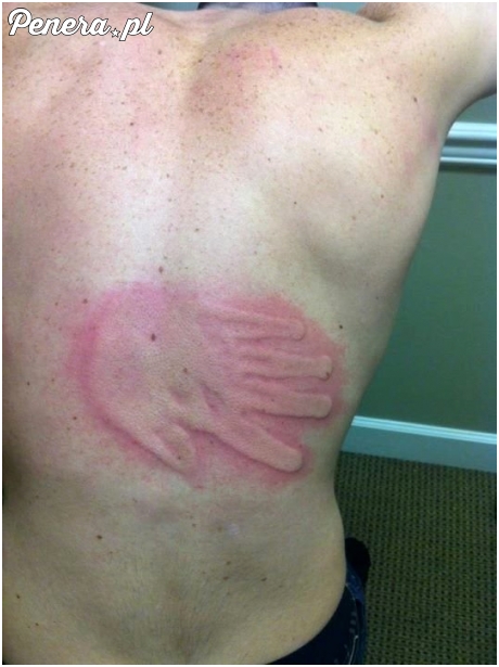 Piąteczka na plecach