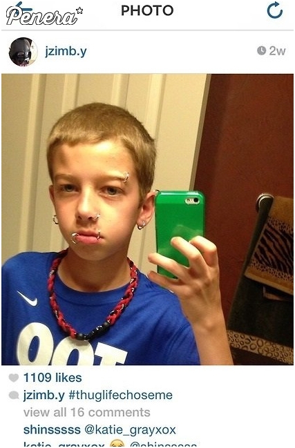 Postępujący debilizm