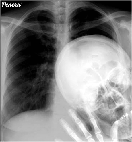 Prawdziwy miszcz pierwszego planu