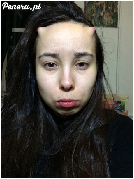 Przejmujesz się dużą myszką na twarzy?