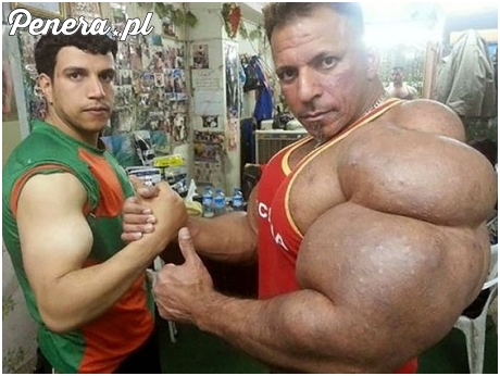 Ubogi umysłowo fan syntholu